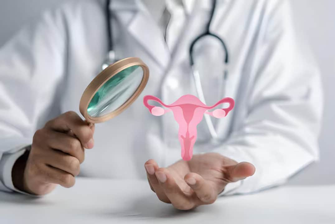 Tumores ginecológicos: se diagnostican 30 casos por día en Argentina