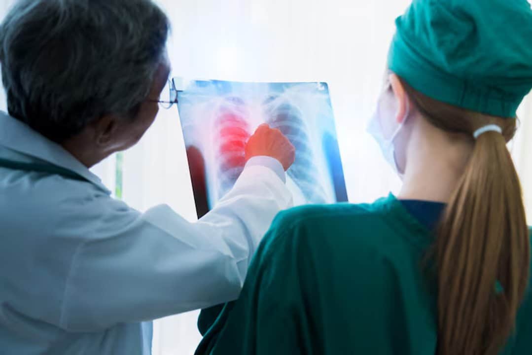 La falta de aire y la tos persistente pueden ser señales de una enfermedad que deja cicatrices en los pulmones