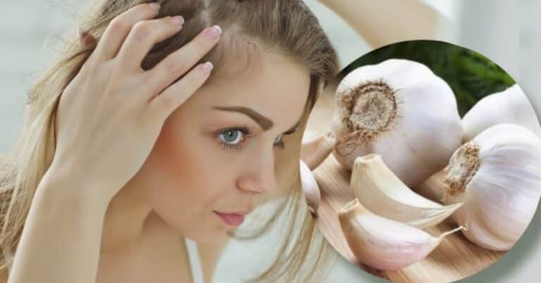 Cómo usar el ajo para fortalecer el cabello y evitar la caída del pelo