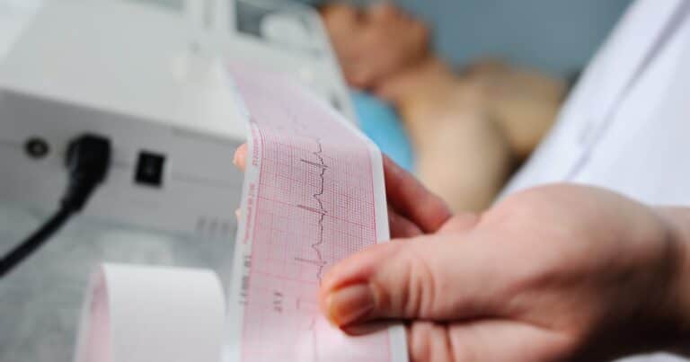 Qué enfermedades pueden salir en un electrocardiograma