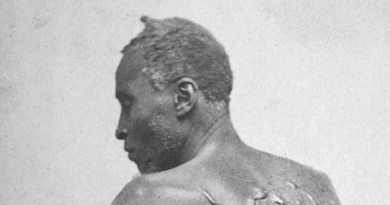 La historia de «Peter azotado», el esclavo que escapó y conmovió al mundo con su enorme cicatriz queloide
