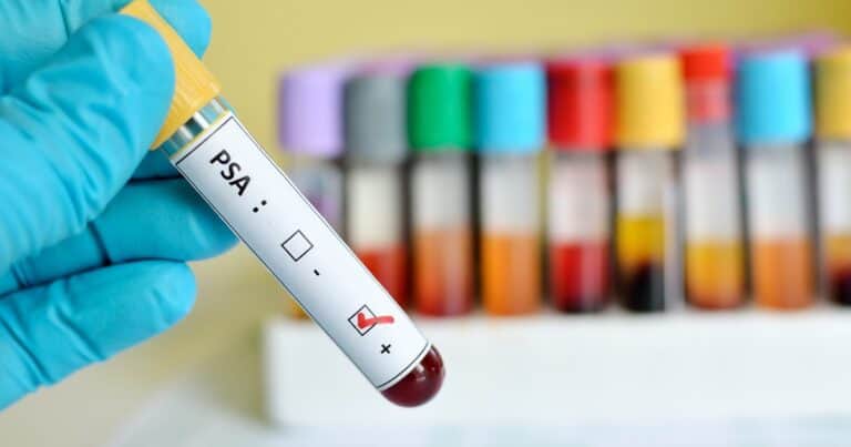 Cuáles son las enfermedades más graves que pueden detectarse con un simple análisis de sangre
