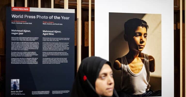 World Press Photo distingue el retrato de un niño palestino que perdió ambos brazos como la Foto del Año