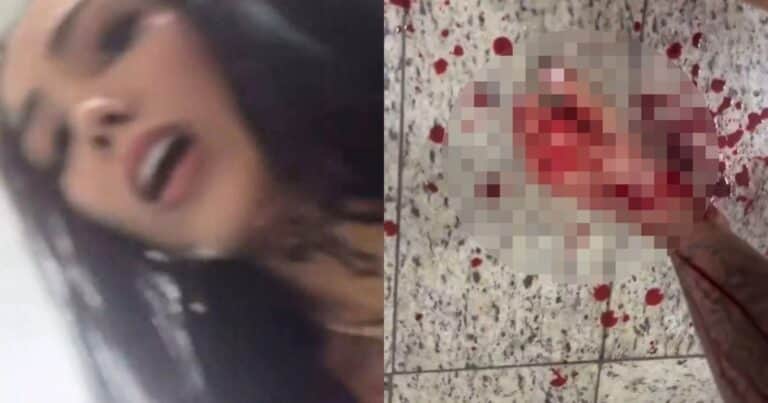 Brutal ataque a una influencer durante una transmisión en vivo: recibió 10 puñaladas