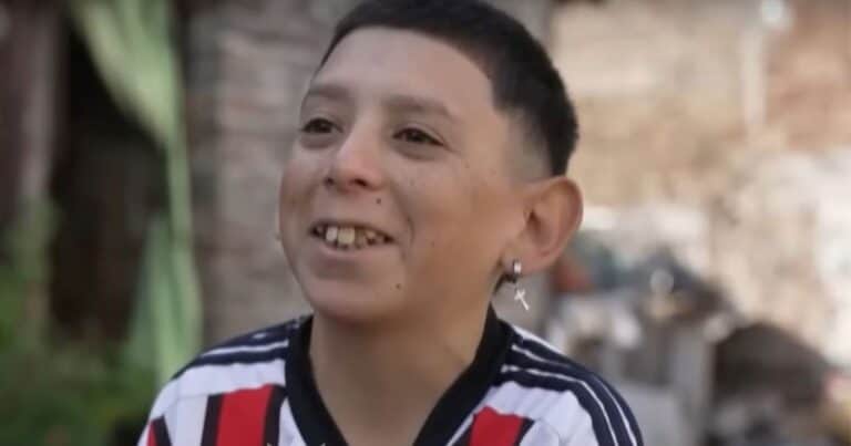 La historia del «Pollo», el argentino de 31 años que parece un nene de 10: «Ya quedé así»