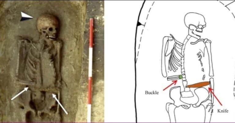 Sorpresa con los restos de un hombre medieval: reemplazó su mano amputada con un cuchillo