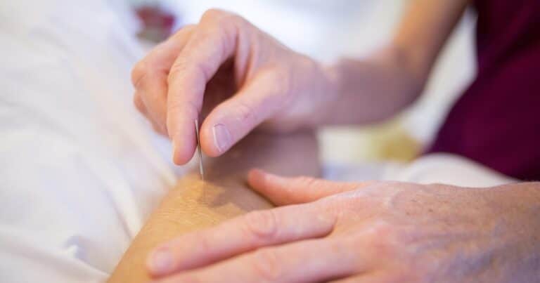 Terapias alternativas: acupuntura y su papel en el alivio del dolor crónico