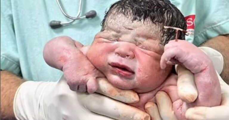“El DIU que no me venció”: la publicación viral de la obstetra que asistió un insólito nacimiento
