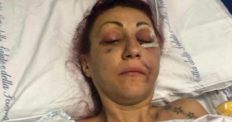 Agredió brutalmente a su ex mujer y el juez lo absolvió «por actuar amargado por la ruptura»