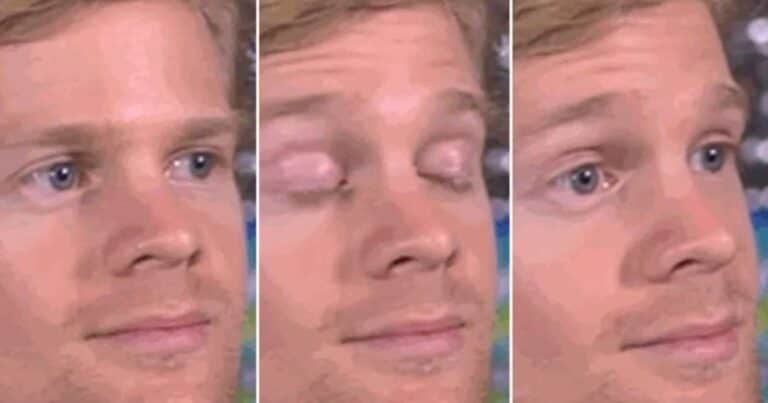 Protagonizó un meme viral y ahora utiliza su fama para apoyar una causa mayor: «Me toca muy de cerca»