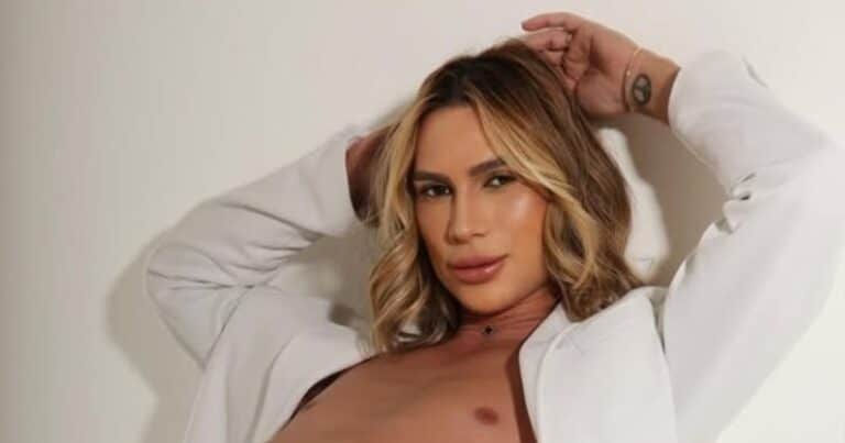 A los 31 años, murió el influencer Junior Dutra tras someterse a la cirugía estética «foxy eyes»