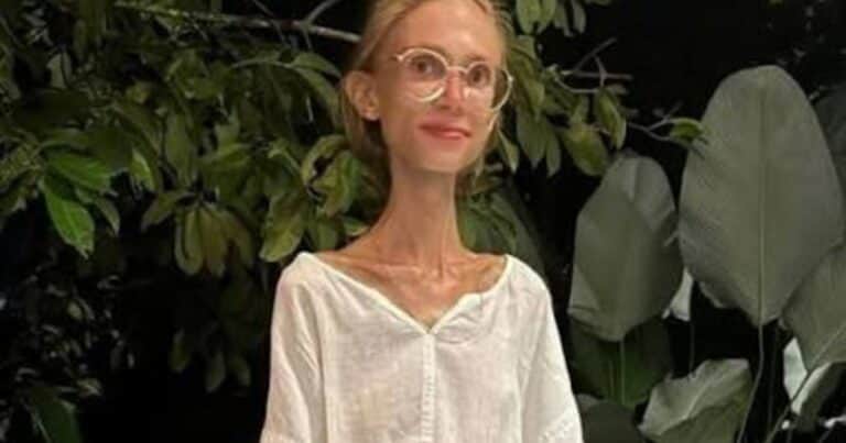 Quién era Karolina Krzyżak, la influencer que se declaró «frutariana», y cómo murió