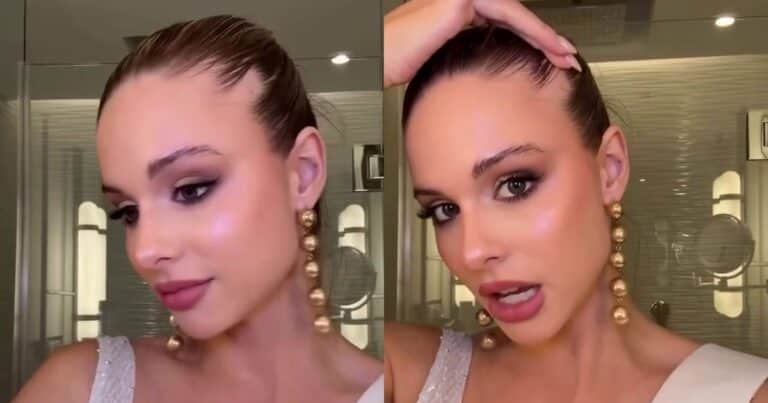 La Miss Universo Argentina sorprende al revelar la afección que sufre en su pelo: “Nací con esta condición»