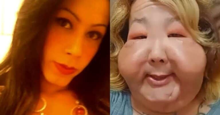 Una operación clandestina la dejó con deformidades: ahora comenzó una dura reconstrucción facial