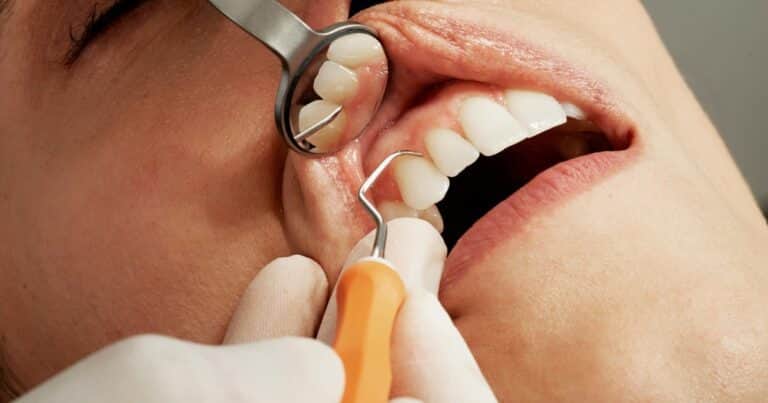 El odontólogo Federico Baena señaló cada cuánto hay que hacer una limpieza dental y reveló un detalle que no puede faltar