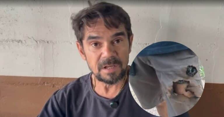 Sufrió el ataque de dos perros en la calle y su teléfono le explotó en la pierna: «Fue peligroso, pero eso me salvó»