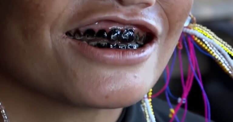 Dientes negros: qué significa este ritual de belleza de 2.000 años de antigüedad
