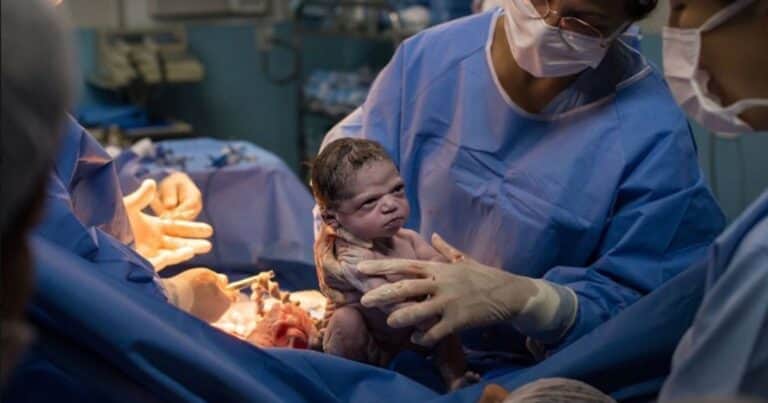 La foto que asombra y enternece: la beba que nació enojada