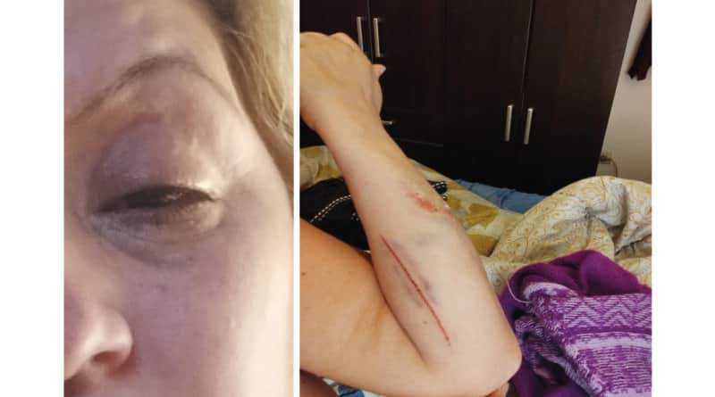 Violencia de género – Karina: reventó a patadas la puerta de la pieza donde estaba encerrada; tenía un cuchillo en la mano