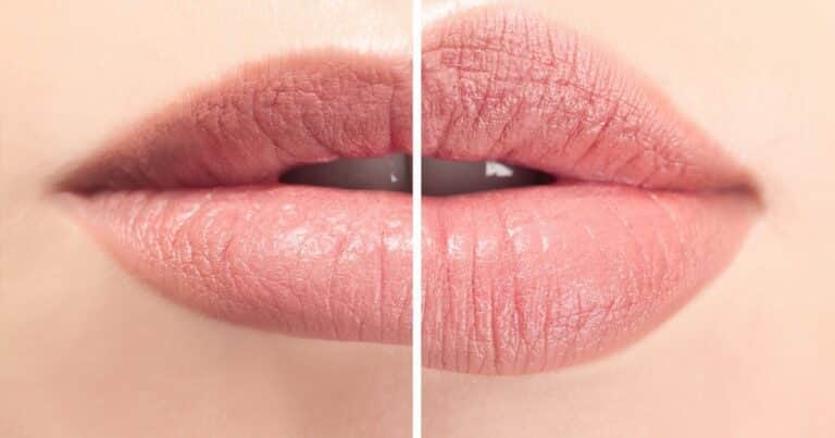 Cómo curar los labios secos y agrietados con remedios simples