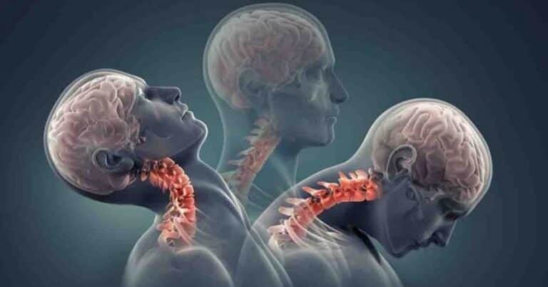 Impactantes fotos del hombre con «síndrome de la cabeza caída» tras años de adicción a las drogas