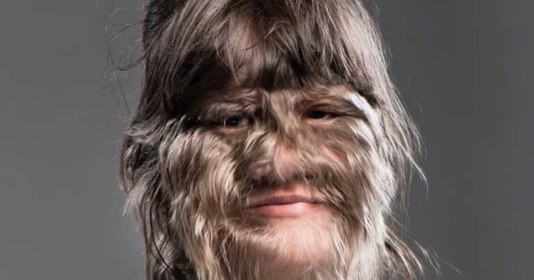 Obtuvo un récord Guinness como «la adolescente más peluda del mundo» y le decían «mujer lobo»: hoy luce muy diferente
