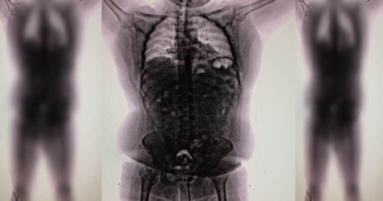 Iba a viajar 36 horas con 90 cápsulas de cocaína en sus intestinos: salió de Perú y cayó en Ezeiza