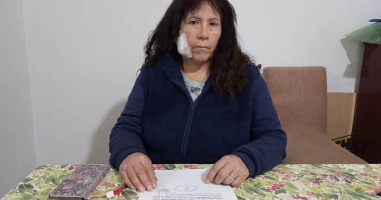 «Pensé que me estaba muriendo»: el terrible relato de la turista atacada con un ladrillazo camino a Ezeiza