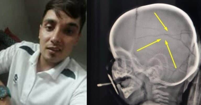 Liberó a un golpeador de niños y lo mandó a un curso de «deconstruyendo masculinidades»: volvió a atacar