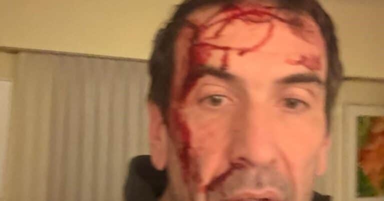 Asaltaron y golpearon a Pablo Cervi, candidato libertario en Neuquén, a horas de las elecciones