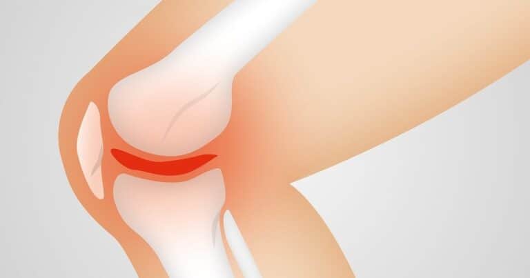 El tai chi alivia el dolor y mejora la movilidad de personas con artrosis de rodilla
