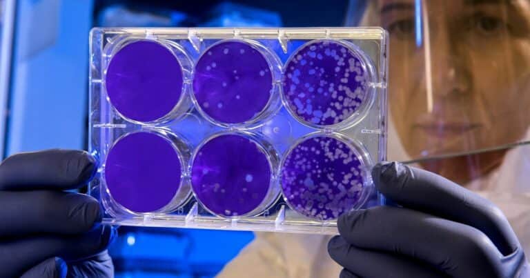 ¿Una estrategia para atacar debilidades ocultas de las células cancerosas?