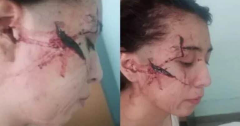 Atacaron a cuchillazos a una joven hasta desfigurarla: tres adolescentes detenidos y un historial de bullying