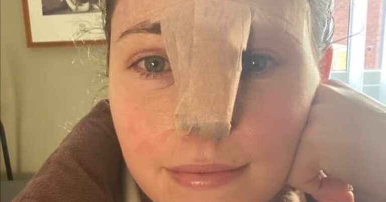 Trabajaba como cuidadora de perros y sufrió un impactante incidente: «Me faltaba gran parte de la nariz»