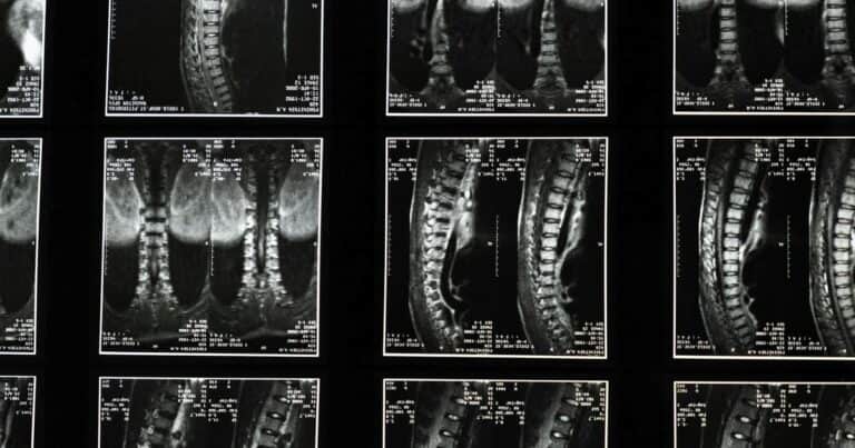 Jose Manuel Felices, doctor: “El dolor de cadera duele y frena. Hay que hacer un ejercicio específico”