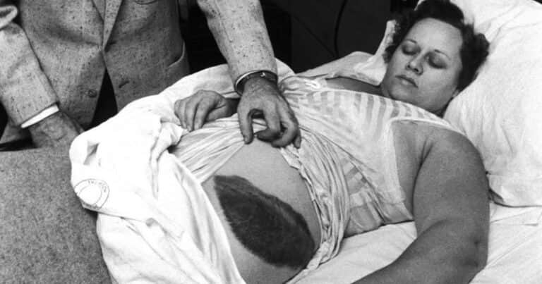 El asombroso caso de Ann Hodges, la única persona alcanzada por un meteorito: qué pasó después