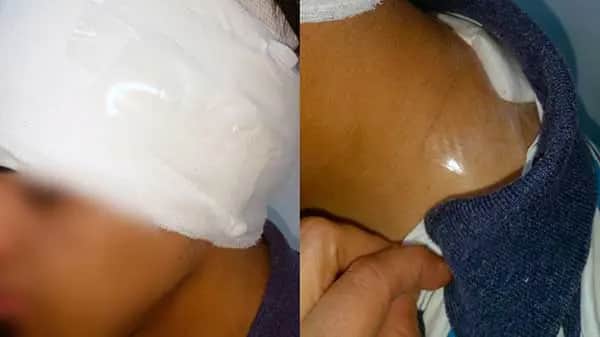Villa Nueva: denuncian ataque con arma blanca a un joven por celos