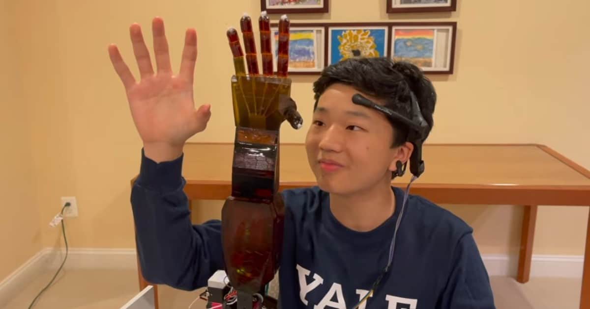Tiene 17 años y diseñó una prótesis de brazo que no necesita cirugía: usó solo una impresora 3D de 75 dólares y un trozo de hilo para pescar