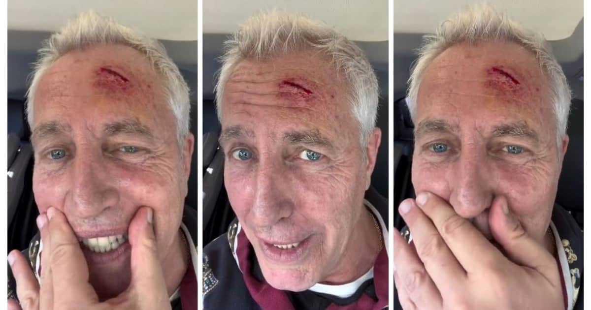 Marley sufrió un fuerte accidente: se golpeó la cabeza y terminó en el hospital
