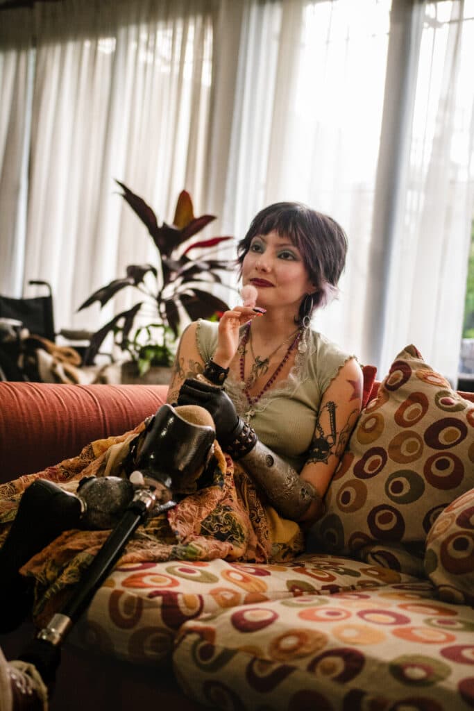 «Si piensan que voy a aflojar, están muy equivocados»: Victoria sigue esperando sus prótesis y le responde a Apross