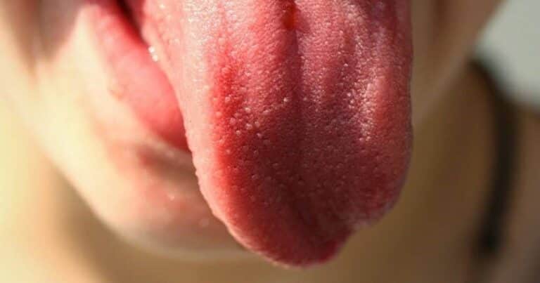 Tuvo una rara sensación en su lengua al comer y descubrió que estaba en peligro: «Algo andaba mal conmigo»