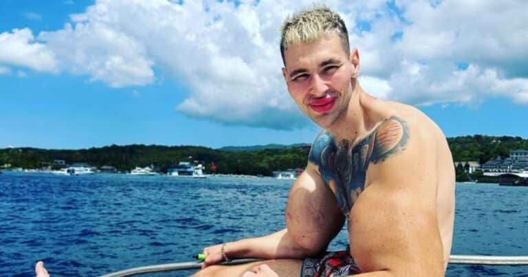 El drama del «Popeye ruso»: por qué los especialistas afirman que podría perder los dos brazos