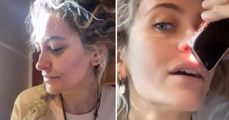 Paris Jackson mostró los efectos del consumo de drogas: «Tengo el tabique perforado»