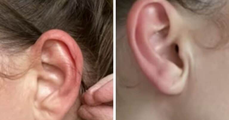 Qué significa cuando te arde la oreja izquierda, según la cultura popular