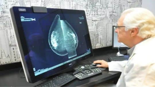 RDI: Alerta por los mamógrafos en Argentina, 1 de cada 3 equipos del sistema público presenta desperfectos