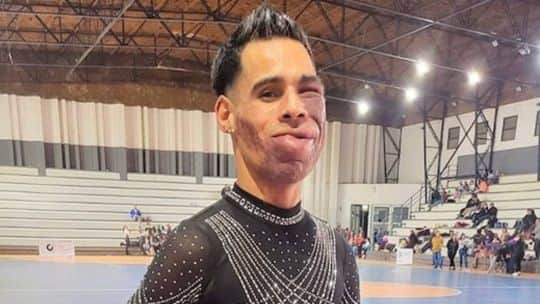 Agredieron al campeón nacional de patinaje artístico en el subte mientras hacía su show