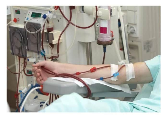 Alerta en diálisis: los aranceles de PAMI cayeron y peligra la atención de afiliados