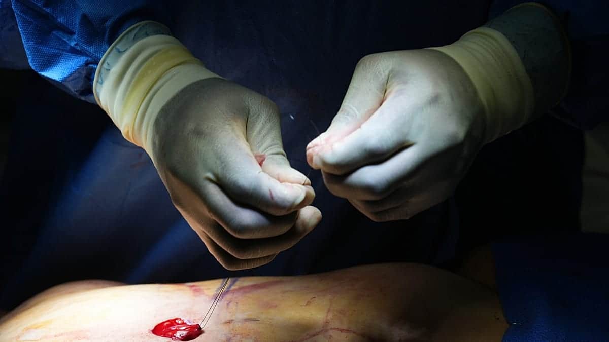 Tailandia investiga la muerte de un influencer británico tras una inyección de aumento de pene