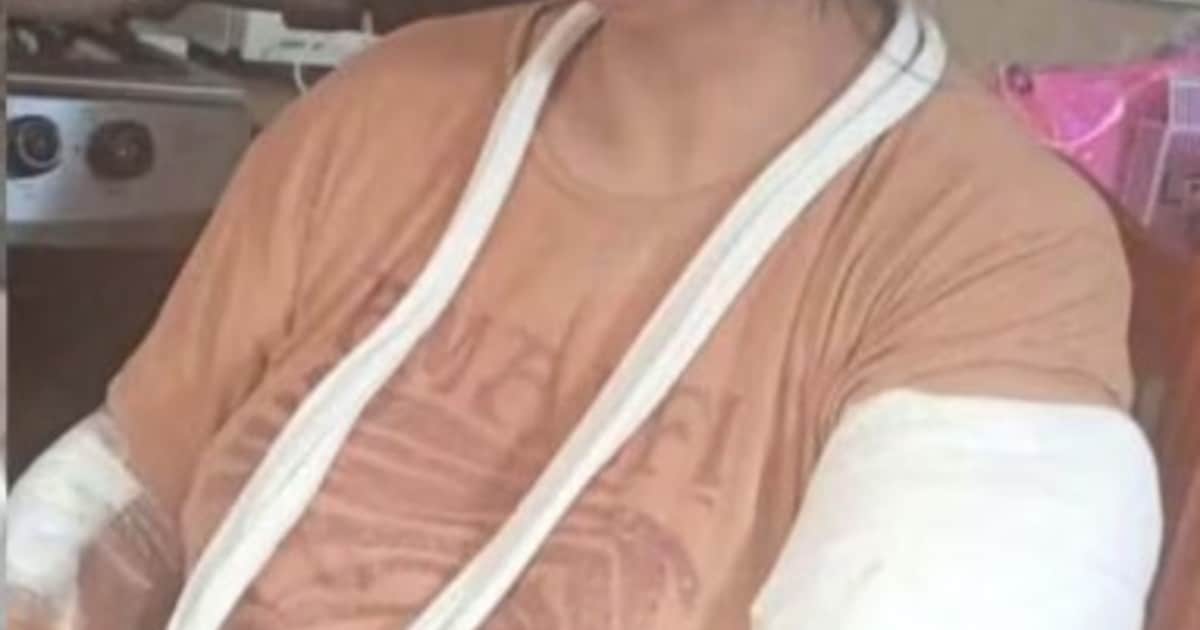 Dramático relato de una mujer atacada por dos dogos en Trelew: "Sólo rogaba que no me maten"